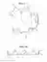 Fig. 03 - Craniotomy closures and plugs