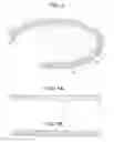 Fig. 09 - Craniotomy closures and plugs