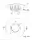 Fig. 17 - Craniotomy closures and plugs