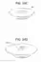 Fig. 32 - Craniotomy closures and plugs
