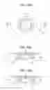 Fig. 34 - Craniotomy closures and plugs