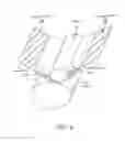 Fig. 07 - INCONTINENCE TREATMENT WITH URETHRAL GUIDE