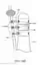 Fig. 20 - INCONTINENCE TREATMENT WITH URETHRAL GUIDE