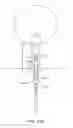 Fig. 30 - INCONTINENCE TREATMENT WITH URETHRAL GUIDE