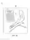 Fig. 35 - INCONTINENCE TREATMENT WITH URETHRAL GUIDE