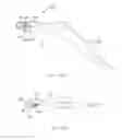 Fig. 37 - INCONTINENCE TREATMENT WITH URETHRAL GUIDE