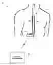 Fig. 01 - Rule-based stimulation program search