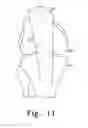 Fig. 05 - BONE PROTECTOR, KIT AND METHOD