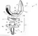 Fig. 01 - Knee joint prosthesis and related method