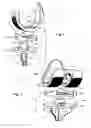 Fig. 02 - Knee joint prosthesis and related method