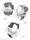 Fig. 03 - Knee joint prosthesis and related method