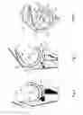 Fig. 04 - Knee joint prosthesis and related method