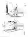 Fig. 07 - Knee joint prosthesis and related method