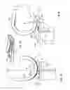 Fig. 09 - Knee joint prosthesis and related method