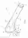 Fig. 02 - PROSTHETIC HIP IMPLANTS