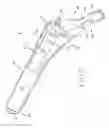 Fig. 03 - PROSTHETIC HIP IMPLANTS