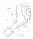 Fig. 07 - PROSTHETIC HIP IMPLANTS