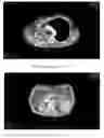 Fig. 01 - Computer implemented methods of treating lung cancer