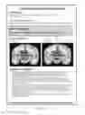 Fig. 13 - Neuropsychiatric test reports