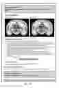 Fig. 15 - Neuropsychiatric test reports