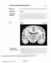 Fig. 20 - Neuropsychiatric test reports
