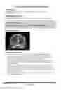 Fig. 26 - Neuropsychiatric test reports