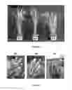 Fig. 40 - Plants Having Modulated Carbon Partitioning and a Method for Making the Same