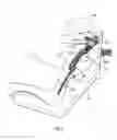 Fig. 08 - HEAD AND NECK SUPPORT DEVICE