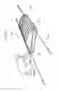 Fig. 06 - Portable safety skylight replacement assembly