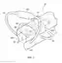 Fig. 05 - Fluid impingement arrangement