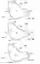 Fig. 11 - Reversible rod tong assembly