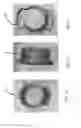 Fig. 08 - Trunnion nose guard