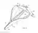 Fig. 08 - Anchor cover
