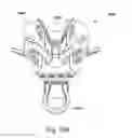 Fig. 136 - Nasal mask system