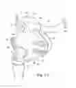Fig. 04 - Mask system