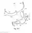 Fig. 46 - Mask system