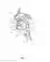 Fig. 02 - SYSTEMS AND METHODS FOR TREATMENT OF SLEEP APNEA