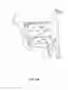 Fig. 32 - SYSTEMS AND METHODS FOR TREATMENT OF SLEEP APNEA