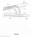 Fig. 45 - SYSTEMS AND METHODS FOR TREATMENT OF SLEEP APNEA