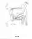 Fig. 49 - SYSTEMS AND METHODS FOR TREATMENT OF SLEEP APNEA