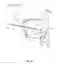 Fig. 65 - SYSTEMS AND METHODS FOR TREATMENT OF SLEEP APNEA