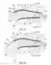 Fig. 05 - Tongue retainer