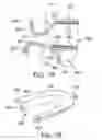 Fig. 06 - Tongue retainer