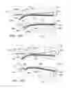 Fig. 12 - Tongue retainer