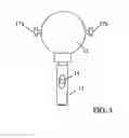 Fig. 04 - Applicator for the delivery of solutions and materials in a pressurized fluid system