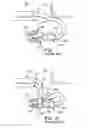 Fig. 02 - Assembly for securing a wire harness to a sensor coupler
