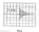 Fig. 03 - Use of electromagnetic pulses in cross-flow filtration systems