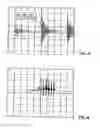 Fig. 04 - Use of electromagnetic pulses in cross-flow filtration systems