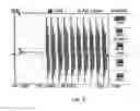 Fig. 05 - Use of electromagnetic pulses in cross-flow filtration systems