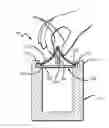 Fig. 01 - Pinch top closure system